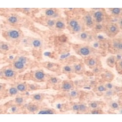 Lecithin Cholesterol Acyltransferase (LCAT) Antibody