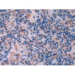 Lecithin Cholesterol Acyltransferase (LCAT) Antibody