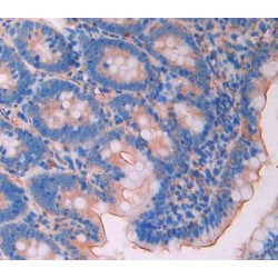 Lecithin Cholesterol Acyltransferase (LCAT) Antibody