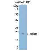 Western blot analysis of the recombinant protein.