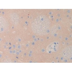 Lecithin Cholesterol Acyltransferase (LCAT) Antibody