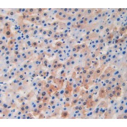 Lecithin Cholesterol Acyltransferase (LCAT) Antibody