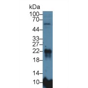 Western blot analysis of Rat Lung lysate, using Rat MFAP5 Antibody (5 µg/ml) and HRP-conjugated Goat Anti-Rabbit antibody (<a href="https://www.abbexa.com/index.php?route=product/search&amp;search=abx400043" target="_blank">abx400043</a>, 0.2 µg/ml).