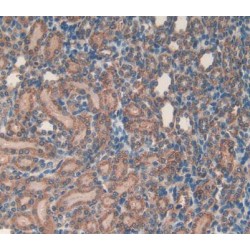 Microfibrillar Associated Protein 5 (MFAP5) Antibody