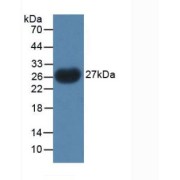 Western blot analysis of recombinant Chicken PTHrP.