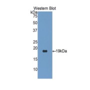 Western blot analysis of the recombinant protein.