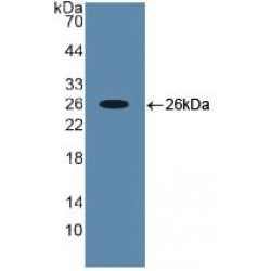 Runt Related Transcription Factor 2 (RUNX2) Antibody