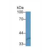 Western blot analysis of Human Lung lysate, using Mouse SFRP1 Antibody (2 µg/ml) and HRP-conjugated Goat Anti-Rabbit antibody (<a href="https://www.abbexa.com/index.php?route=product/search&amp;search=abx400043" target="_blank">abx400043</a>, 0.2 µg/ml).