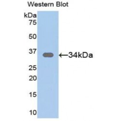 Secreted Frizzled Related Protein 1 (SFRP1) Antibody