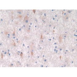 Secreted Frizzled Related Protein 5 (SFRP5) Antibody