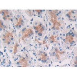 Secreted Frizzled Related Protein 5 (SFRP5) Antibody