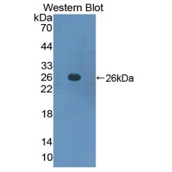 Suppressors of Cytokine Signaling 3 (SOCS3) Antibody