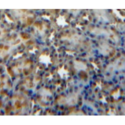 Suppressors of Cytokine Signaling 3 (SOCS3) Antibody