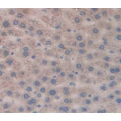 T-Cell Leukemia/lymphoma Protein 1A (TCL1A) Antibody