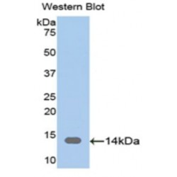 Adenylyl Cyclase Associated Protein 1 (CAP1) Antibody