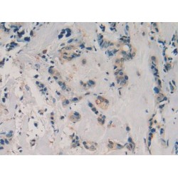 Zinc-Alpha-2-Glycoprotein (AZGP1) Antibody