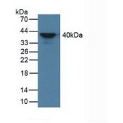 Western blot analysis of Human Serum.
