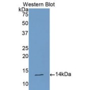 Western blot analysis of recombinant Human Cardiotrophin Like Cytokine Factor 1 (CLCF1).