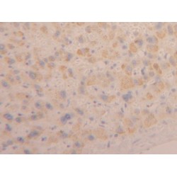 Cardiotrophin Like Cytokine Factor 1 (CLCF1) Antibody