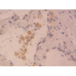 Cardiotrophin Like Cytokine Factor 1 (CLCF1) Antibody