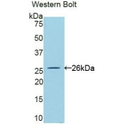 Western blot analysis of the recombinant protein.