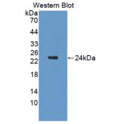 Western blot analysis of the recombinant protein.