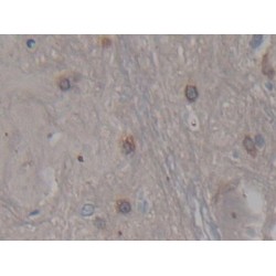 Cerebral Dopamine Neurotrophic Factor (CDNF) Antibody