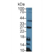 Western blot analysis of Rat Thymus lysate, using Mouse CD30L Antibody (5 µg/ml) and HRP-conjugated Goat Anti-Rabbit antibody (<a href="https://www.abbexa.com/index.php?route=product/search&amp;search=abx400043" target="_blank">abx400043</a>, 0.2 µg/ml).