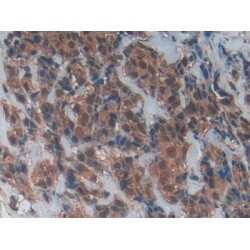 Cluster of Differentiation 40 Ligand / TNFSF5 (CD40LG) Antibody