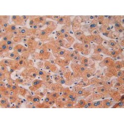 Cluster of Differentiation 40 Ligand / TNFSF5 (CD40LG) Antibody