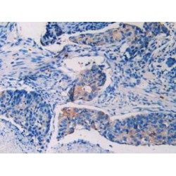 Cluster of Differentiation 40 Ligand / TNFSF5 (CD40LG) Antibody