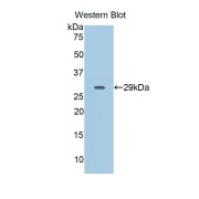 Western blot analysis of the recombinant protein.