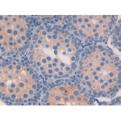 Fatty Acid Binding Protein 9, Testis (FABP9) Antibody