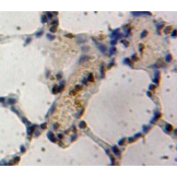 Inhibitory Subunit of NF Kappa B Zeta (IkBz) Antibody