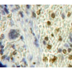 Inhibitory Subunit of NF Kappa B Zeta (IkBz) Antibody