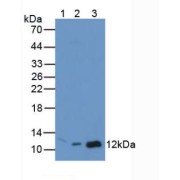 Western blot analysis of (1) Mouse Brain Tissue, (2) Mouse Breast Tissue and (3) Mouse Kidney Tissue.