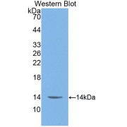 Western blot analysis of the recombinant protein.