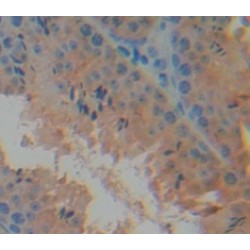 C-C Motif Chemokine 28 / MEC (CCL28) Antibody