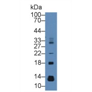 Western blot analysis of Mouse Pancreas lysate, using Rat CCL28 Antibody (2 µg/ml) and HRP-conjugated Goat Anti-Rabbit antibody (<a href="https://www.abbexa.com/index.php?route=product/search&amp;search=abx400043" target="_blank">abx400043</a>, 0.2 µg/ml).