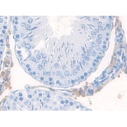 C-C Motif Chemokine 28 / MEC (CCL28) Antibody