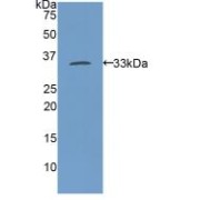 Western blot analysis of recombinant Rat MYH11.