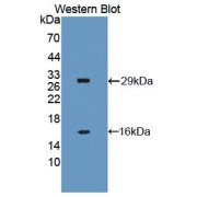 Western blot analysis of the recombinant protein.