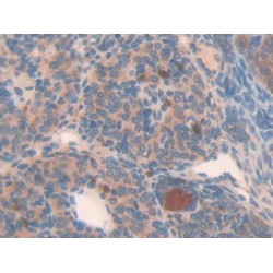 Neuronal Apoptosis Inhibitory Protein (NAIP) Antibody