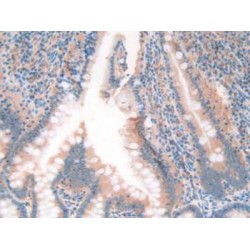 Protein Z Dependent Protease Inhibitor (ZPI) Antibody