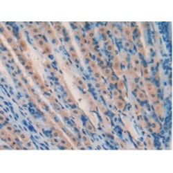 Superoxide Dismutase 2 (SOD2) Antibody