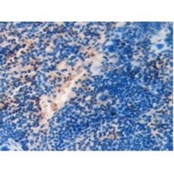 Superoxide Dismutase 2 (SOD2) Antibody