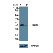 Western blot analysis of (1) Wild-type HeLa cell lysate, and (2) SOD2 knockout HeLa cell lysate, using Rabbit Anti-Rat SOD2 Antibody (1 µg/ml) and HRP-conjugated Goat Anti-Mouse antibody (<a href="https://www.abbexa.com/index.php?route=product/search&amp;search=abx400001" target="_blank">abx400001</a>, 0.2 µg/ml).