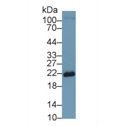 Superoxide Dismutase 2 (SOD2) Antibody