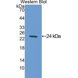 Superoxide Dismutase 2 (SOD2) Antibody