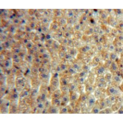 Superoxide Dismutase 2 (SOD2) Antibody